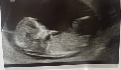 Fun boy or girl guesses?