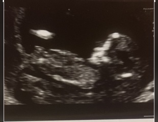 Gender guesses- nub theory