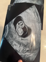 Pregnant after ivf - 5 weeks 