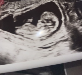 Pregnant after ivf - 5 weeks 