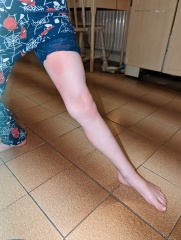 Help needed identifying a rash on my child 