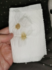 Bronchitis? Warning gross photo!! 