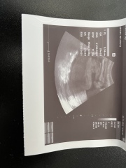 Is this a boy or girl scan?