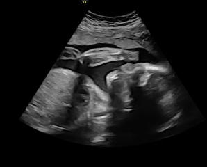 Due March 2023 - thread 5