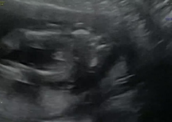 Potty shot - worried gender was wrong 