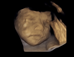 Due March 2023 - thread 5