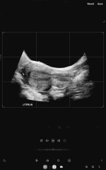 Due May 2023 - thread two