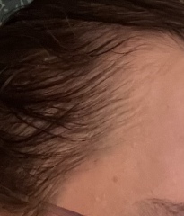 Is this thin hair or am I going bald ? Have a look at the pics 