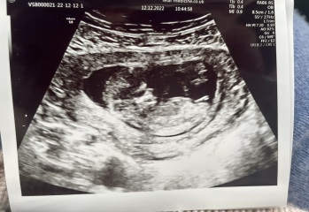 Nub - boy or girl guesses?