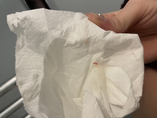 Implantation bleeding