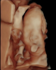 Due March 2023 - thread 5