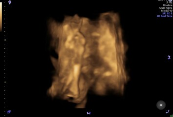 Due March 2023 - thread 5