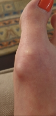 To ask what this thing is on my foot??