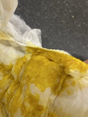 Is this baby poo and rash normal?