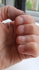 Successful ways to stop biting nails?