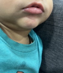 Does this look like a drool rash? 