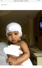 7 month old doing weird eye squeezing - really worried