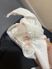 Am I having a miscarriage? (Images attached!)