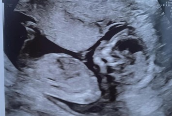 Boy or girl?