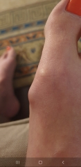 To ask what this thing is on my foot??