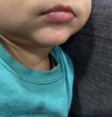 Does this look like a drool rash? 