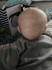 Worried possible craniosynostosis In 7 week old who sleeps just all the time?