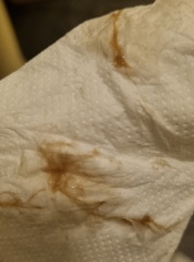 Am I having a miscarriage? (Images attached!)