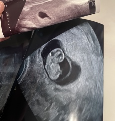 ABC IVF timeline & advice