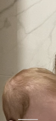 newborn hair turning orange?