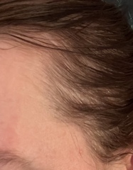 Is this thin hair or am I going bald ? Have a look at the pics 