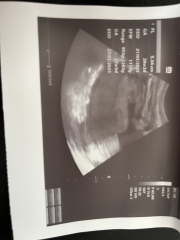 Is this a boy or girl scan?