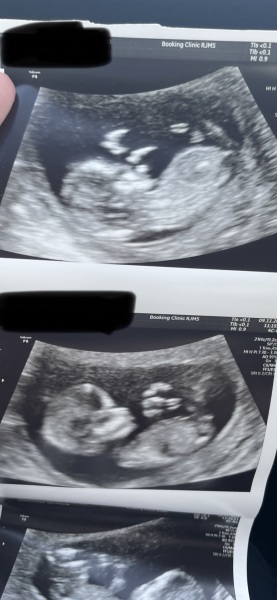 Boy or girl