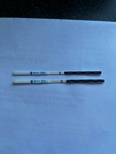 I have had trigger shot yesterday for first time 