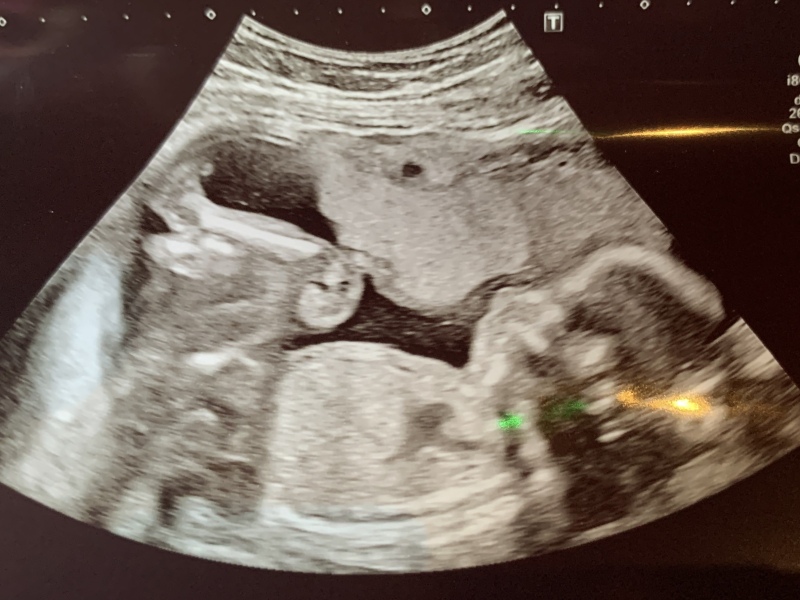 June 2023 Babies ☀️ (Thread 3) 