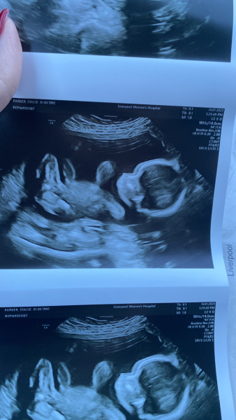 June 2023 Babies ☀️ (Thread 3) 