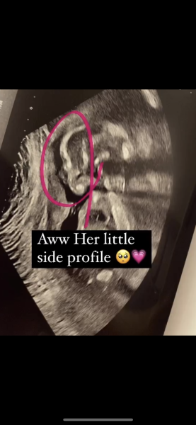 June 2023 Babies ☀️ (Thread 3) 