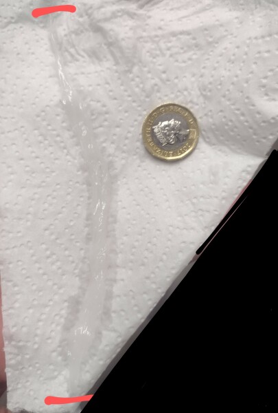 Wtf have I just blown out my nose?!