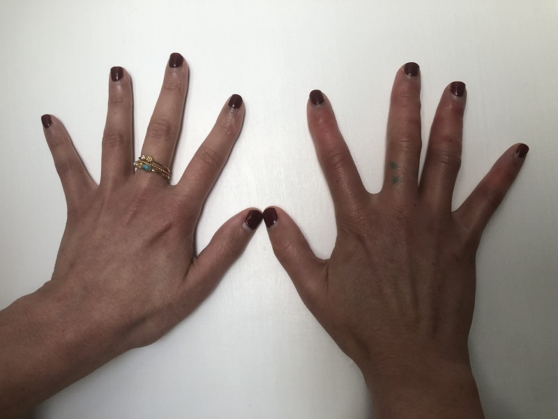 Help diagnose my hands (photo)