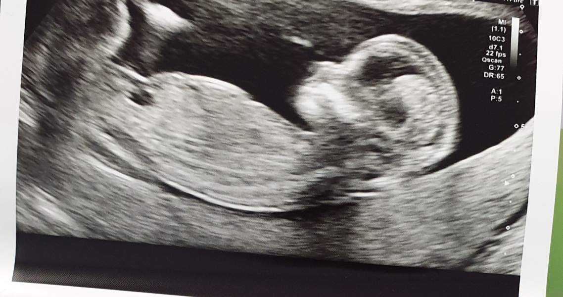 Gender guesses