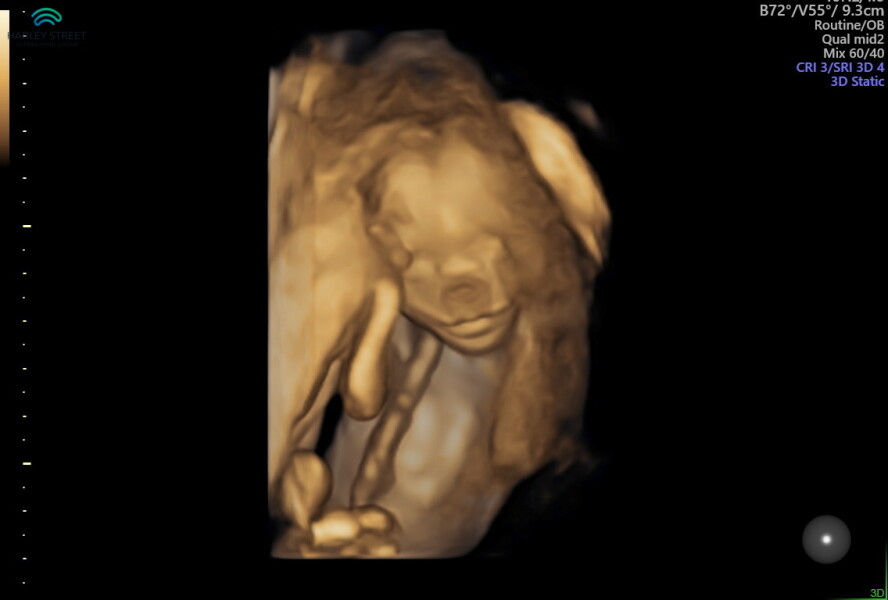 June 2023 Babies ☀️ (Thread 3) 