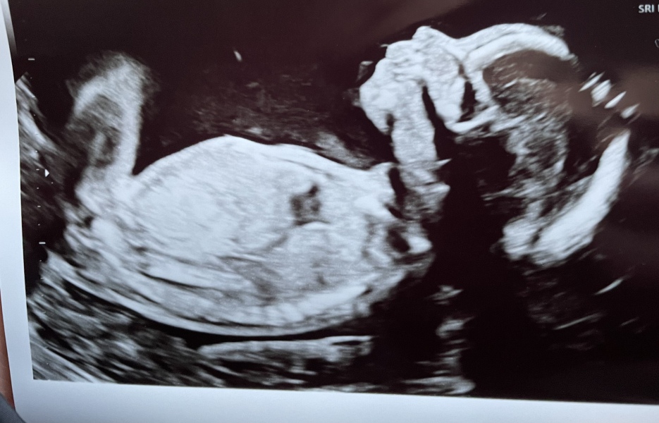 June 2023 Babies ☀️ (Thread 3) 