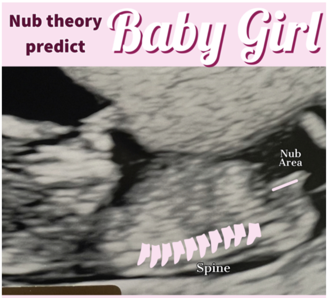 Nub theory guesses 💖💙