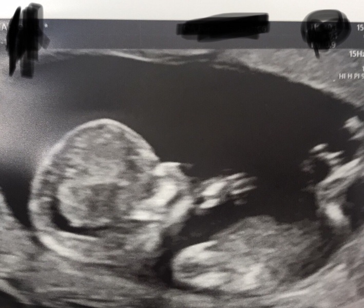 For fun! Boy or Girl?