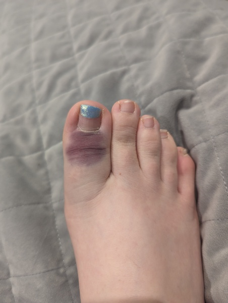 Does this need an x-ray?
