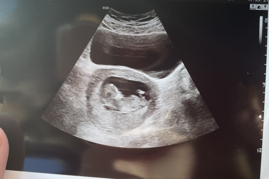 August Due Date Crew - Into Trimester 2 (Thread 6)