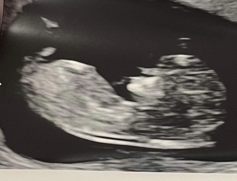 Boy or girl?