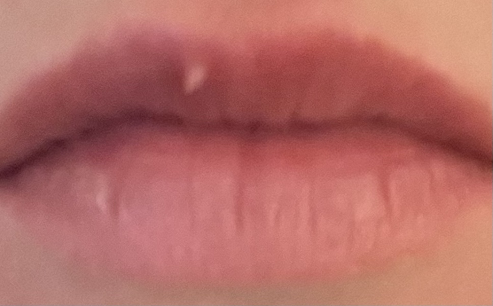What is this on my lip? 