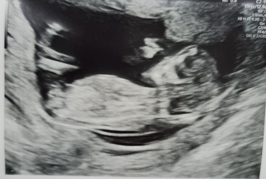 Boy or Girl? 