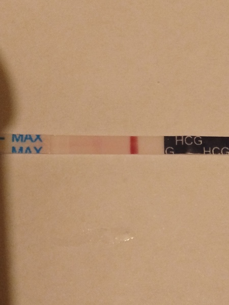 I have had trigger shot yesterday for first time 