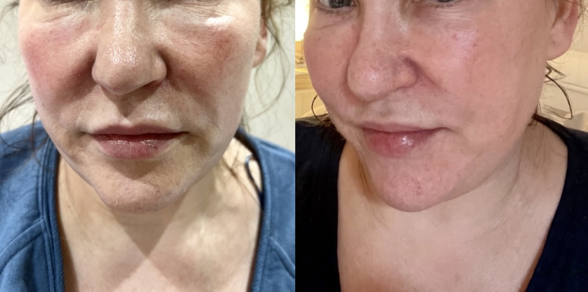 Beauty treatments that have wowed you